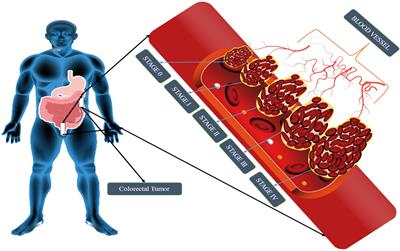 Recent advances in nanomedicine preparative methods and their therapeutic potential for colorectal cancer: a critical review